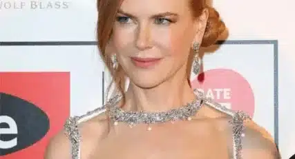 nicole kidman chirurgie esthétique