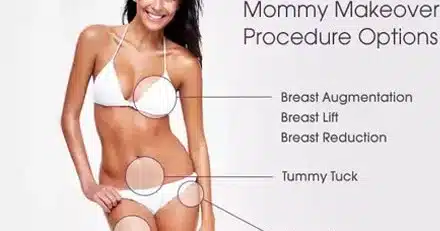 Femme en bikini blanc montrant les options de relooking post-maternité.