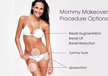 Femme en bikini blanc montrant les options de relooking post-maternité.