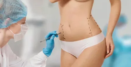 liposuccion tunisie